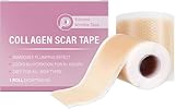 Silikon Narbenpflaster für Gesicht, Silicone Scar Tape, 4 X 150 cm Silikonpflaster für Narben, Face Tape Ultradünn Flexibel für Alle Hauttypen, Sicher und Wirksam Bei Narben und Keloiden