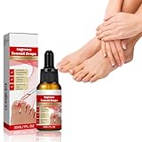 30ml Eingewachsene Zehennägel Tropfen, Natural Ingrown Toenail Correction Oil, Ingrown Toenail Treatment Drop, Korrektur Behandlung Öl, Anti Paronychia Relief Oil für Beschädigte Nägel