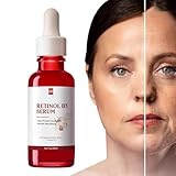 -Tropfen - Strahlende Gesichtsseren,gegen dunkle Flecken, Gesichtsaufhellungs, 30 ml zur Glättung feiner Linien und zur Hautaufhellung, Aufhellung Fulenyi