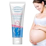 Ezyuanchly Dehnungsstreifen-Creme für Frauen, Narbencreme, Körperfeuchtigkeitscreme, reduziert das Aussehen von Narben und Dehnungsstreifen, Körperstraffungscreme für Narben und Dehnungsstreifen, alle