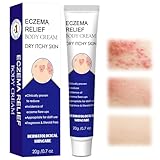20g Ekzem Creme,Ekzemcreme,Ekzem Anti Juckreiz Creme,Repair Creme, sensiderm cream,Beruhigt die Haut