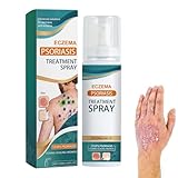 Dermatitis Und Ekzem Creme,Pflegecreme Für Trockene Und Sensible Haut, Stärkt Die Hautbarriere,Juckreiz und gereizter Haut, Geeignet für trockene Haut (1)