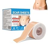 Silikon Narbenpflaster Wiederverwendbar,Narbenpflaster Silikon(4cmx150cm),Silicone Scar Tape Für C-Sektion,Operationen,Verbrennungen,Keloid,Professionell,Hautfreundlich,Atmungsaktiv