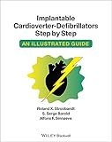 Implantable Cardioverter - Defibrillators Step by Step: An Illustrated Guide