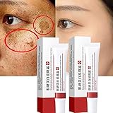 2PCS Whitening Freckle Cream,Scar Removal Treatment Cream,Haut Aufhellende Creme,Dunkle Flecken Aufheller,Dunkle Flecken Sommersprossen entferner,Creme zur Entfernung von Narben (Aufhellungspaste)