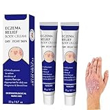 Dermatitis Und Ekzem Creme,Schnelle Linderung bei Ekzemen, Dermatitis, Hautausschlägen, Juckreiz und gereizter Haut, Geeignet für trockene Haut, Ekzeme und Schuppenflechte (2)