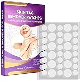 Warzenpflaster，HautanhäNgsel Entfernen，Stielwarzen Entferner，Skin Tag Remover Patches-144 Patches.
