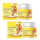 Psoriasis-Creme Anti-Juckreiz-Creme,Advanced Psoriasis Salbe, 𝙋𝙨𝙤𝙧𝙞𝙖𝙨𝙞𝙨 Haut Reparatur Cremes,Dermatophyten an Händen pflegende Cremes für juckende Haut (2)